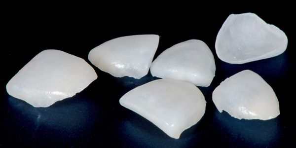 Veneers